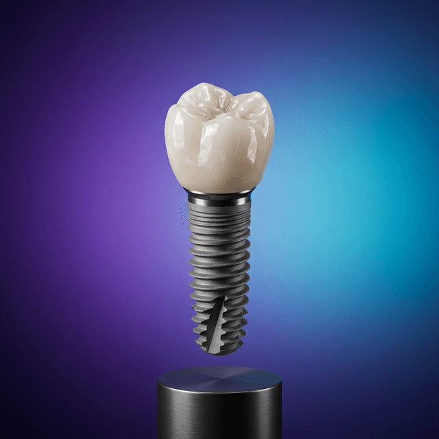 زراعة الأسنان